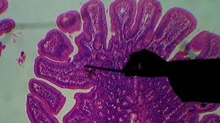 Histologia do Intestino Delgado [upl. by Norbel]