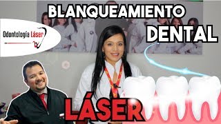 Blanqueamiento dental Láser  Odontología Láser [upl. by Puff]