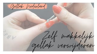 GELLAK VERWIJDEREN  Uitgebreide uitleg  Gellak Nederland [upl. by Quenby]