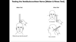 Interpreting the WeberRinne Tests EXPLAINED [upl. by Nasus56]