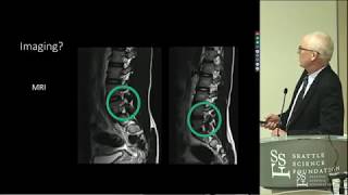 The difference between Spondylosis Spondylolysis Spondylolisthesis [upl. by Anivlem]