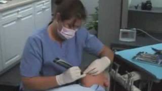 KaVo Diagnodent Pen Laser Fluorescence Caries Detection [upl. by Dicky595]