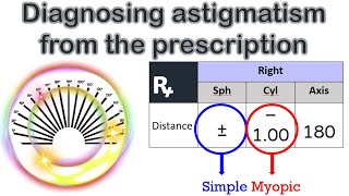 Glasses and Contact Lens Prescription Explained  Eyes Explained [upl. by Eloken]