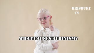 What Causes Albinism [upl. by Eiramenna467]