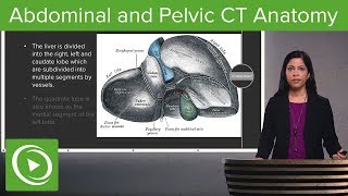 Normal Abdominal amp Pelvic CT Anatomy Algorithm – Radiology  Lecturio [upl. by Rochella741]