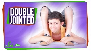 Why Are Some People DoubleJointed [upl. by Israel]