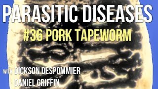 Parasitic Diseases Lectures 36 Pork Tapeworm [upl. by Eiuqnimod]