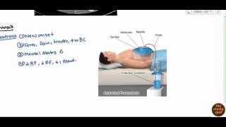 Ascites for USMLE Step 2 [upl. by Tegirb]