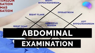 Abdominal Examination  OSCE Guide Latest  UKMLA  CPSA  PLAB 2 [upl. by Yrokcaz]