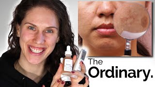 THE ORDINARY  3 BEST DARK SPOTS amp PIGMENTATION PRODUCTS [upl. by Hoeve]