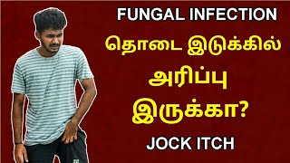 தொடை இடுக்கில் அரிப்பு இருக்கா  Fungal infections  Jock itch  Causes  Prevention  Tamil  MM [upl. by Power]