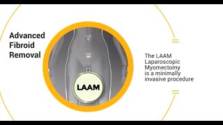 Laparoscopic Pelvic and Aortic Lymphadenectomy [upl. by Lonne]