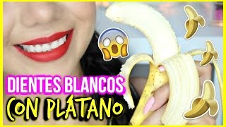 BLANQUEA TUS DIENTES CON CÁSCARA DE PLÁTANO 🍌  MARIEBELLECOSMETICS [upl. by Hinckley783]