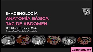 TAC DE ABDOMEN  ANATOMÍA RADIOLÓGICA BÁSICA [upl. by Eissalc]