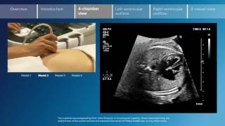 How To OB Ultrasound  Normal Pregnancy Case Study Video [upl. by Dabney744]