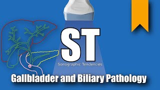 Gallbladder and Biliary Pathology [upl. by Gniliem790]