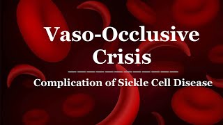 VasoOcclusive Crisis  Complication of Sickle Cell Disease [upl. by Enyawed]