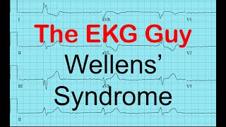 Wellens Syndrome  EKGECG Course 1200  The EKG Guy  wwwekgmd [upl. by Noired]