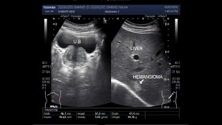 Introduction to Multiphase CT amp MRI of the Liver [upl. by Rehpotsirh]