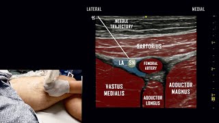 Adductor Canal Block  Ultrasound Anatomy Review [upl. by Reg336]