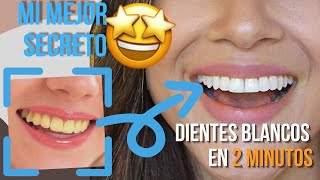 Cómo BLANQUEAR LOS DIENTES con ACEITE DE COCO y Cúrcuma 🤫 ideas en 5 en 5 MINUTOS [upl. by Suravart45]