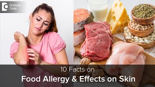 Food Allergy amp how it affects SKIN  Causes Symptoms amp TreatmentDrRajdeep Mysore Doctors Circle [upl. by Ameekahs599]