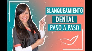 Blanqueamiento Dental Paso a Paso  Doctora Verónica [upl. by Azaria396]