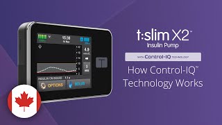 Insulin  Sliding Scale vs Basal Bolus orders Nursing [upl. by Lalaj]