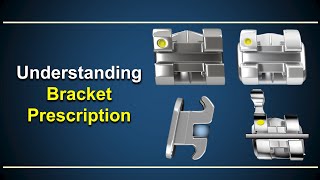 Understanding Bracket Prescription [upl. by Ilrebmik]