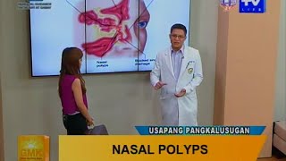 Good Morning Kuya What is Nasal Polyps [upl. by Pussej]