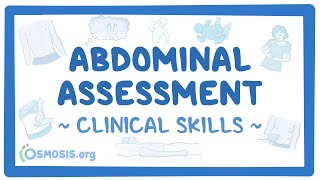 Abdominal Assessment Clinical Skills [upl. by Farnham]