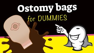 Ostomy bags for dummies [upl. by Aiuqet]